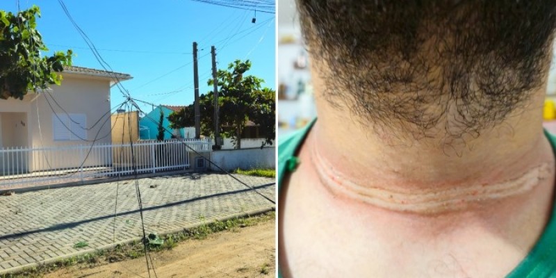 Acidente em Jaguaruna: Motociclista ferido por fio solto na via